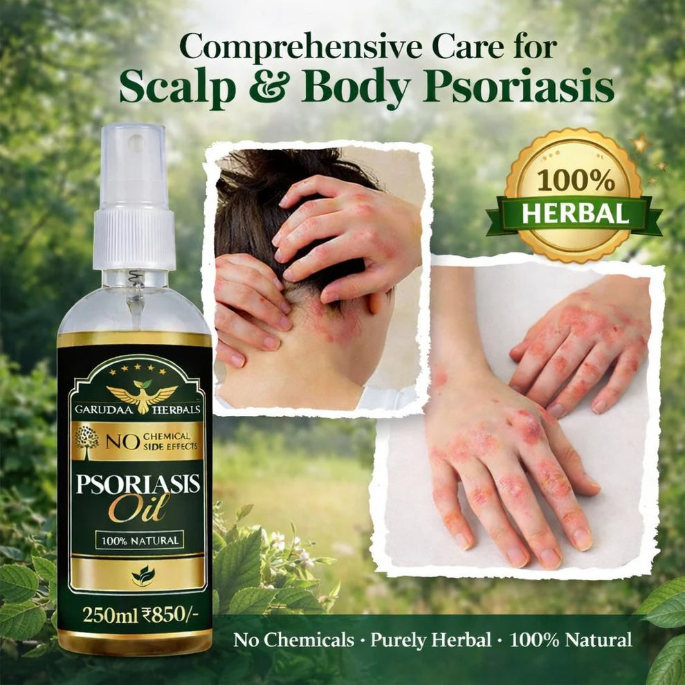 Garuda Herbal Psoriasis -Clearing Oil